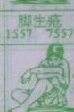 梦到脚生疮对应的排列五号码图示